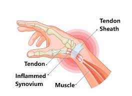 wrist pain